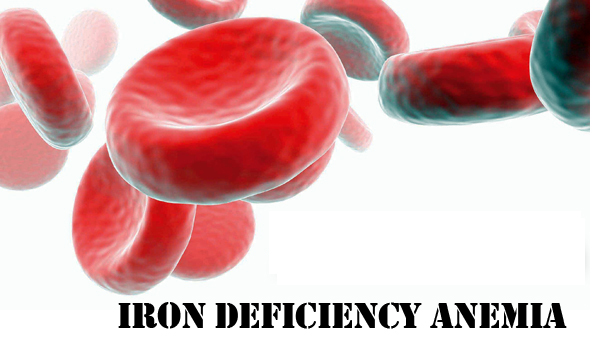 Iron deficiency anemia