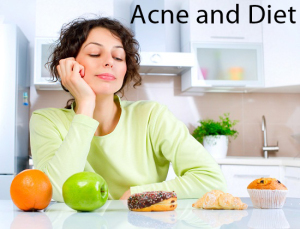 acne-and-diet