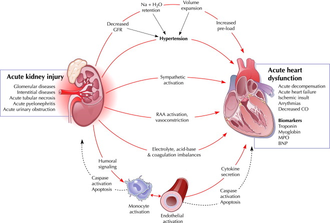 cardiac