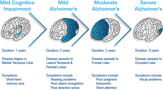 alzprogress